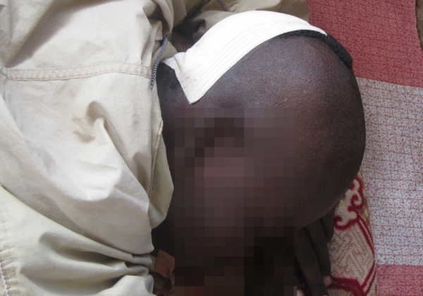 무슬림들의 공격에 머리와 턱을 부상당한 17세 크리스천. ⓒ오픈도어