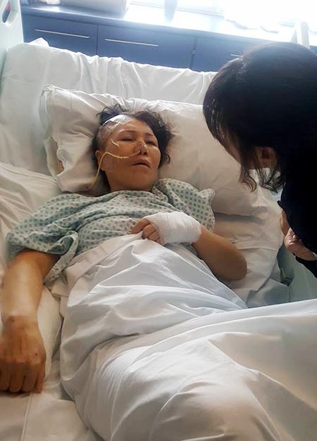 ▲전공수 목사가 사고를 당한 박춘애 할머니를 처음 만난 후 얼마 지나지 않아 찍은 사진. 이 때만 해도 할머니의 상태는 그리 좋지 못했다고 한다. 당시 전공수 목사는 "제가 본 박춘애 할머니는 옛날 어머님들의 깔끔한 모습 그대로였다. 당신의 아픔과 힘든 일 보다는, 주변 사람들이 자기 때문에 이런 고생을 해서는 안 된다는 말씀을 계속하셨다"며 "'이렇게 추한 모습을 보여서 어떻게 하나? 빨리 집에 가고 싶다. 앞으로 한 달 있으면, 자녀들이 효도관광 보