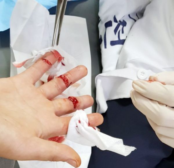 ▲손가락을 부상당한 시민이 치료를 받고 있다.