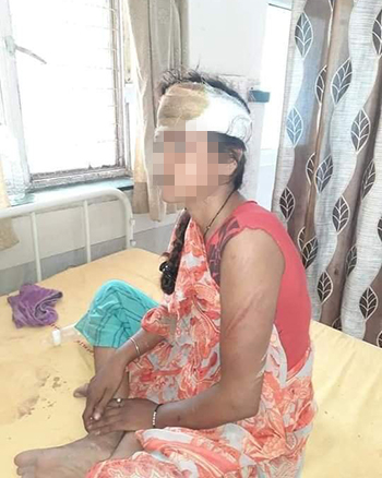 이번 공격으로 라제쉬 목사의 딸(사진)도 부상을 입었다. 다행히 라제쉬 목사와 딸은 13일 퇴원했다. ©한국오픈도어