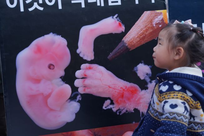 낙태된 태아를 보고 울상 짓는 아이. ⓒ김신의 기자