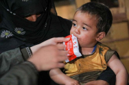 영양실조에 걸린 시리아 아동 자이드에게 중증 급성 영양실조 치료식인 플럼피넛을 먹이는 모습. ⓒ월드비전