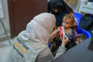 월드비전을 통해 영양실조 치료식을 지원받고 있는 시리아 아동의 모습. ⓒ월드비전