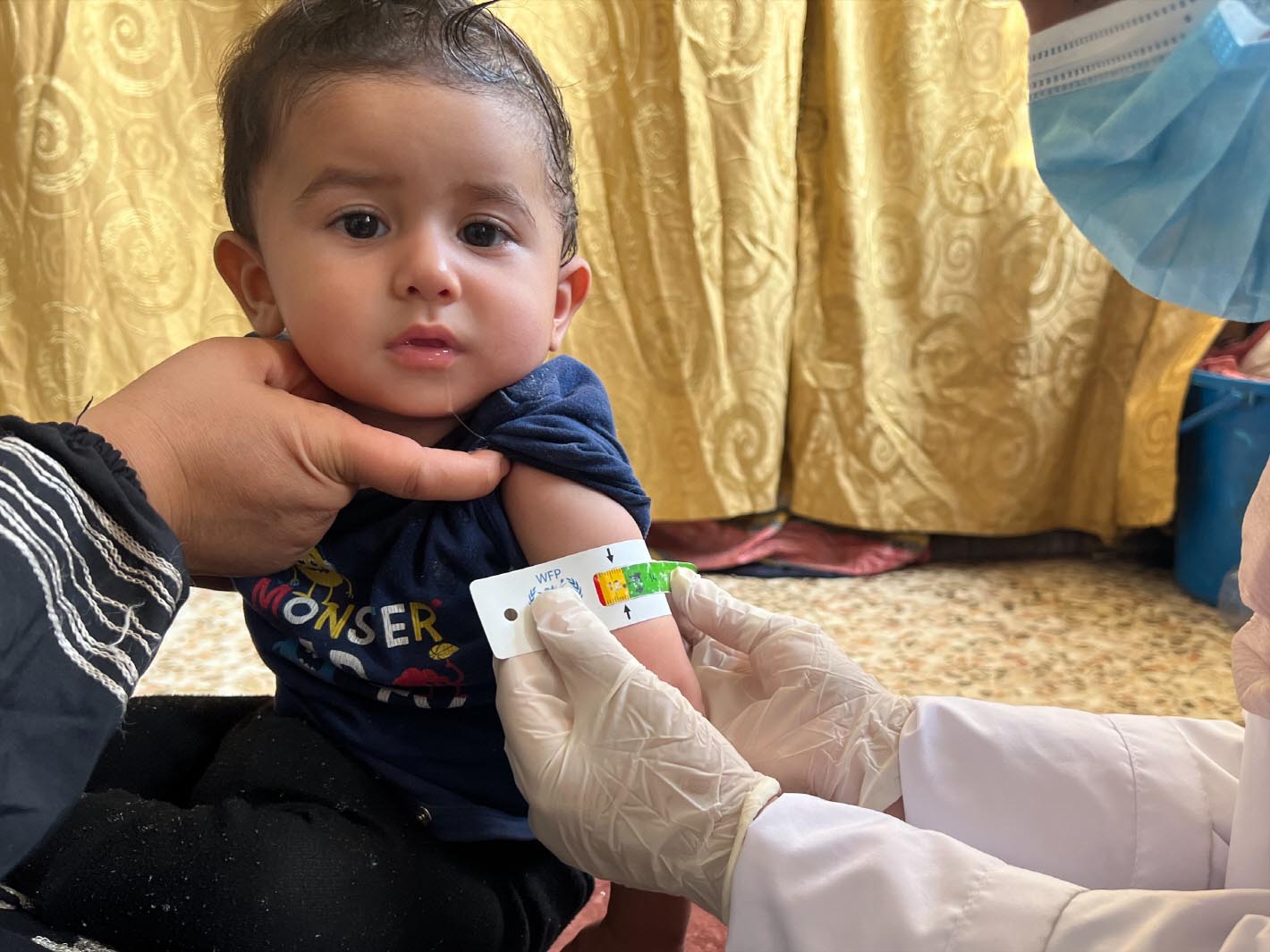 ▲시리아 북동부 피난민 아동이 월드비전의 의료 및 영양 지원을 받고 건강 체중으로 회복된 모습. ⓒ월드비전