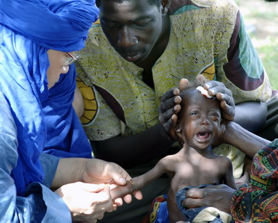 주 선교사(맨 왼쪽)가 영양주사를 놓으려 했지만 손바닥 만한 아이에게서 혈관을 찾기란 매우 어려웠다.