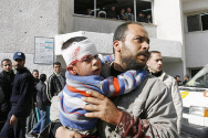 이스라엘, 팔레스타 전쟁에서 폭격으로 머리를 다친 아이를 아버지가 안고 있다. ⓒ월드비전