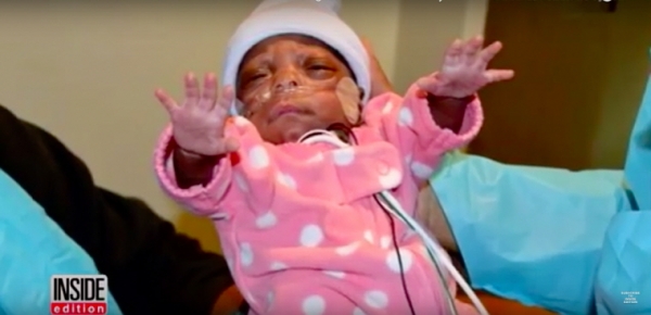 기적의 여자 아기 엘라야 페이스 페가스 (E'layah Faith Pegues). ©유튜브 캡춰